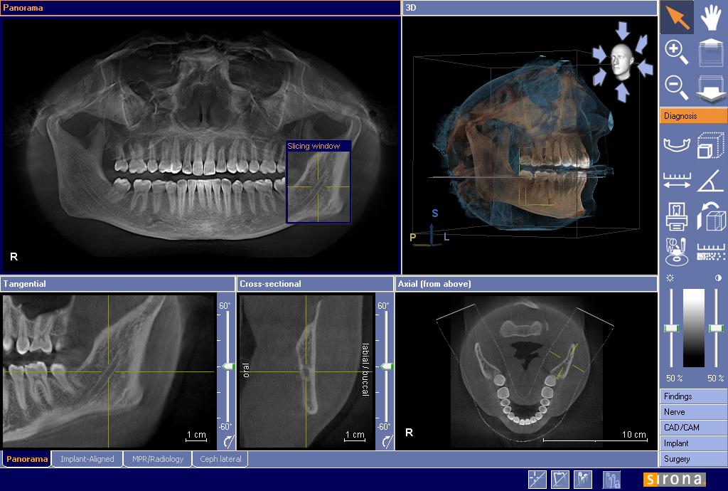 Кт д т. Компьютерная томография зубов. Компьютерная томограмма 3d зубы.