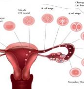 IVF Treatment Hyderabad