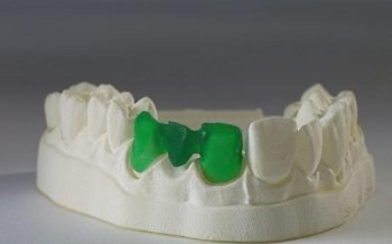 3D Dental Scanners 