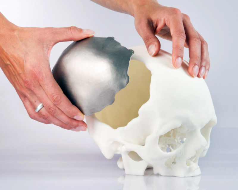 3D Printing Medical Device Market