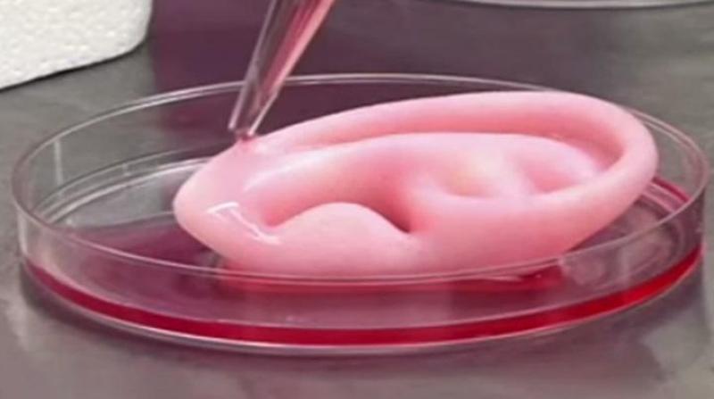 3D Printing in Healthcare