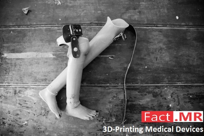 3D-Printing- Medical-Devices