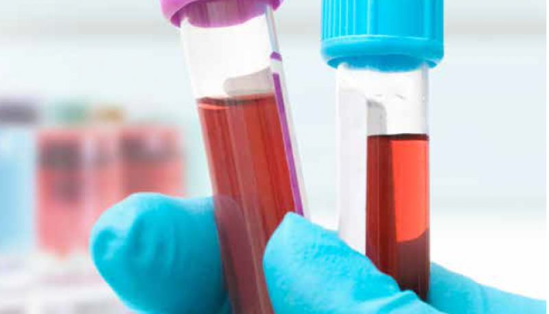 A latest addition to the DecisionDatabases.com repository is the addition of United States Blood Collection Monitors Industry 2016 Market Research Report. The report along with the industry analysis gives a detailed account of big manufacturers and producers of the industry.