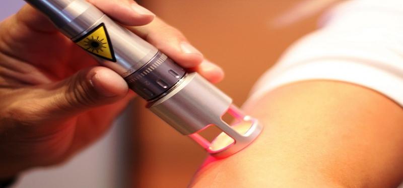 Acupuncture Laser