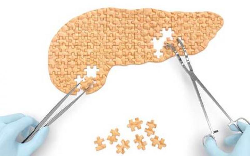 Acute pancreatitis