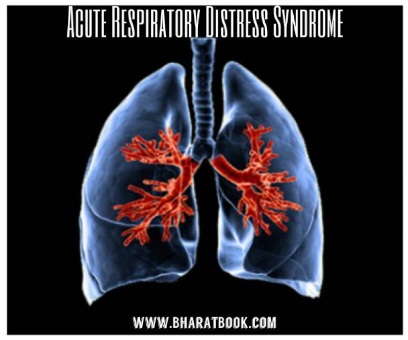 Respiratory Distress