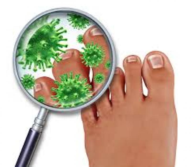 Antifungal Drugs