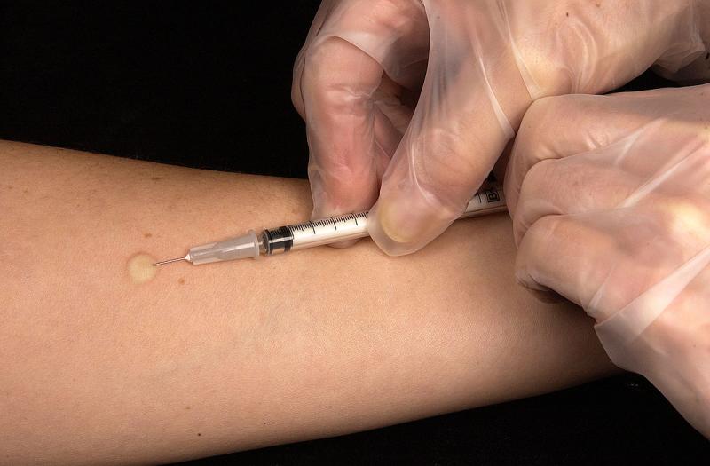 Antigen Skin Test Market 
