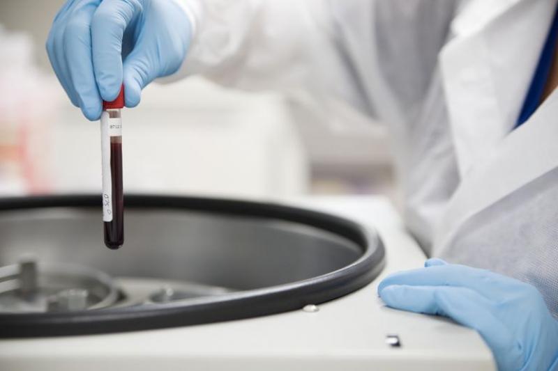 Antinuclear Antibody Test Market worth USD 1,901.7 Million by 2023 Antinuclear Antibody Test