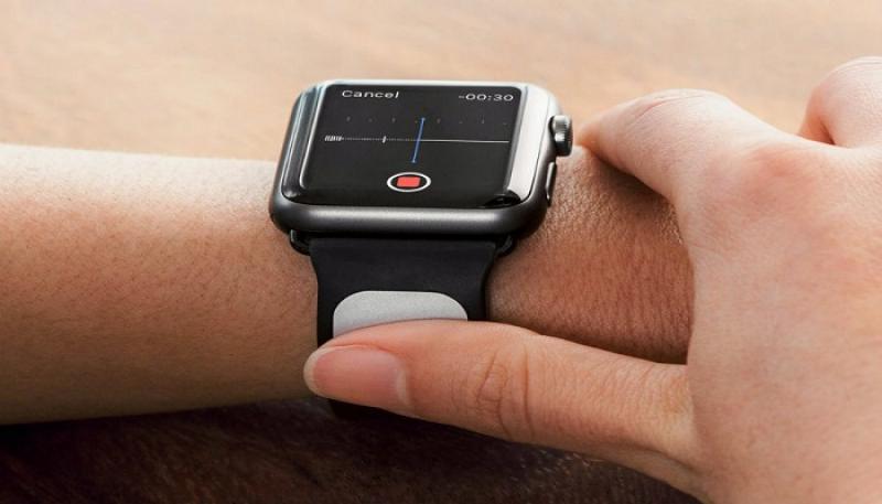 Global Arrhythmia Monitoring Devices Market