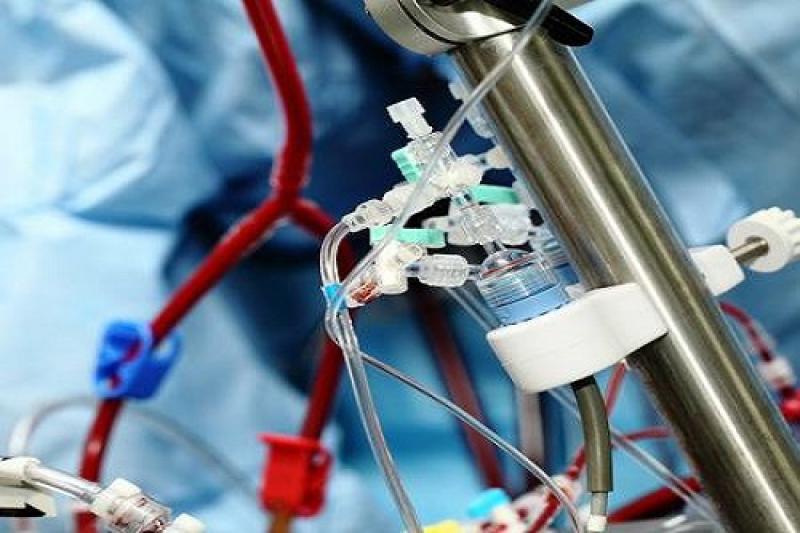 Artificial HeartLung Machine