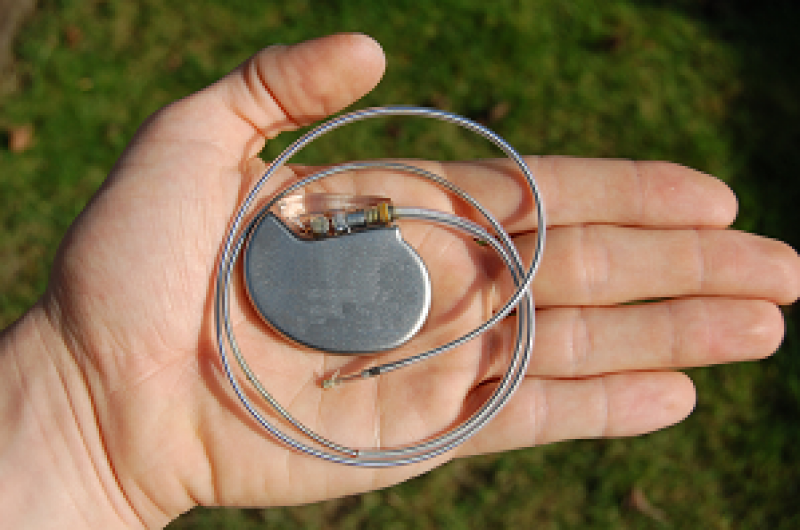 Asia Pacific Cardiac Pacemaker Market