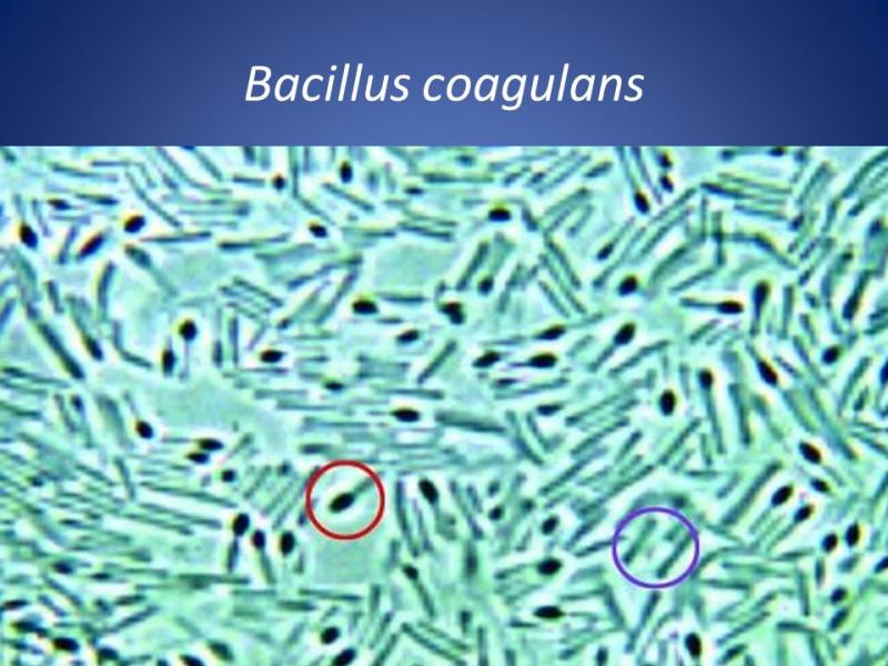 Bacillus Coagulans Market