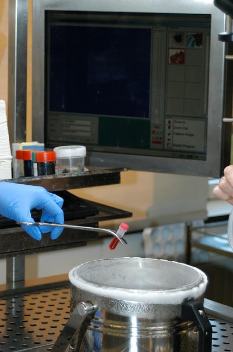 Biobanking Market