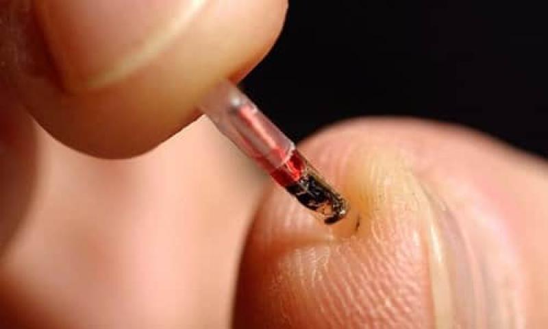 Biochips Market