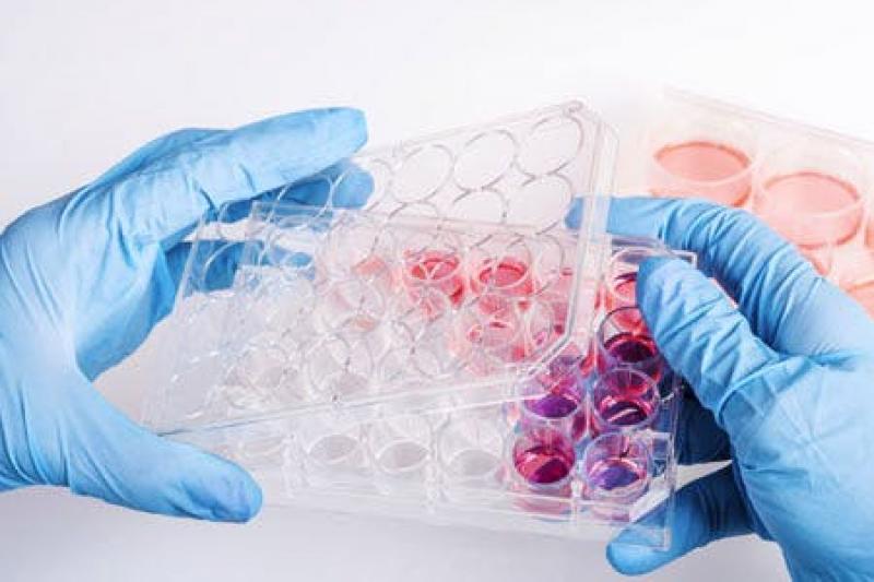 Biosimilar Monoclonal Antibodies