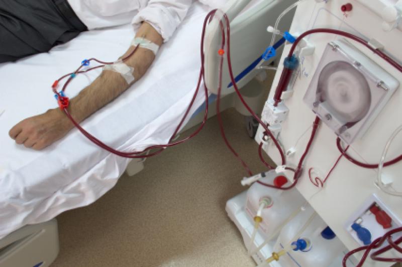Global Blood Dialysis Machines Industry Situation and Prospects Research report Blood Dialysis Machines