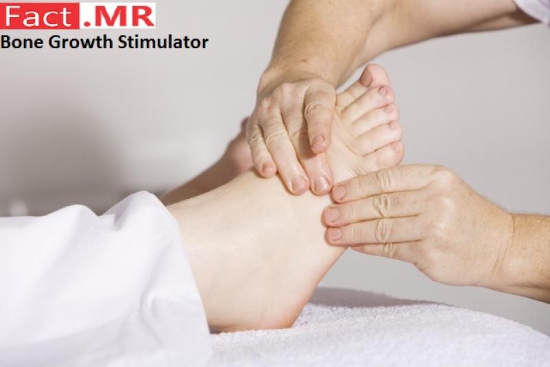 Bone Growth Stimulator