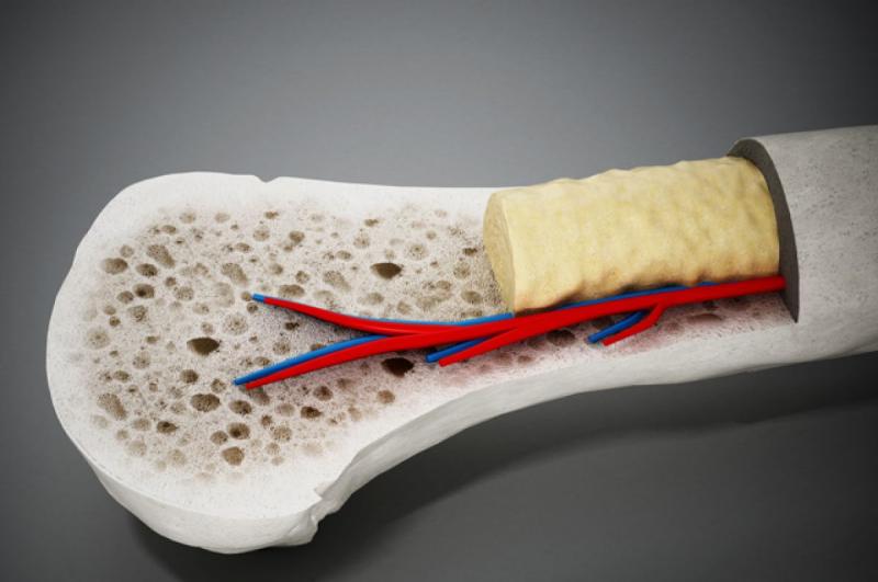 Bone Marrow Transplant Market