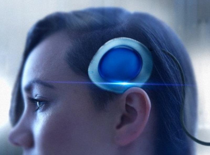 Brain Implants Market