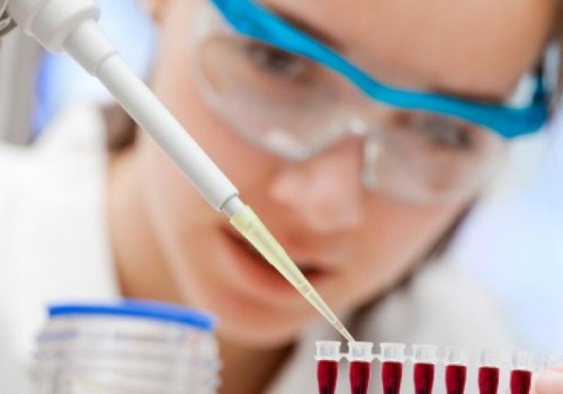 Buccal Drug Delivery Systems