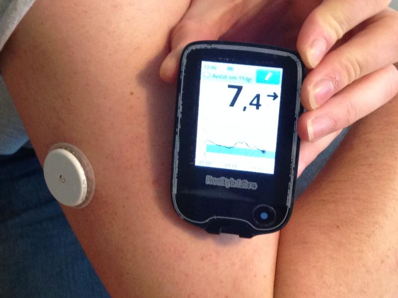 Continuous Glucose Monitoring Devices Market