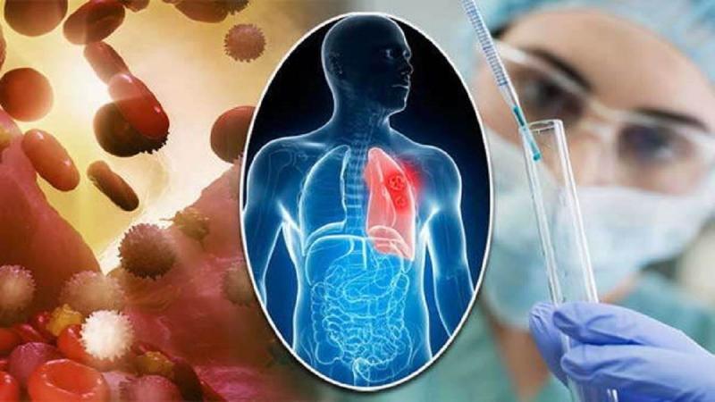 Cancer Therapy Market