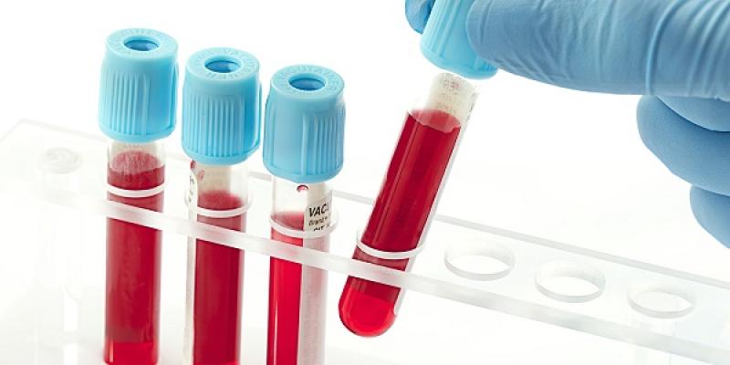 Carcinoembryonic Antigen