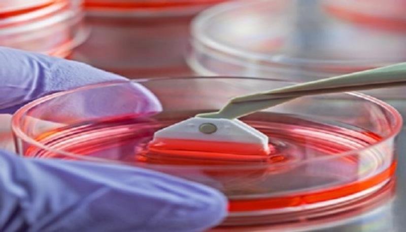Cell Harvesting Market
