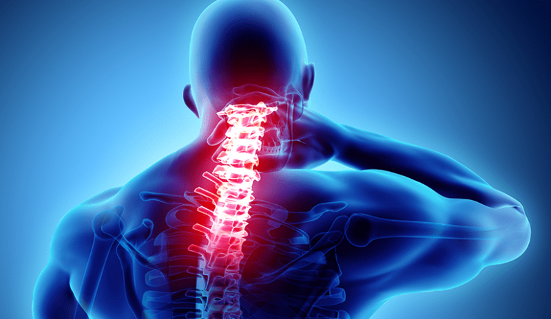 Cervical Spondylosis Treatment Market