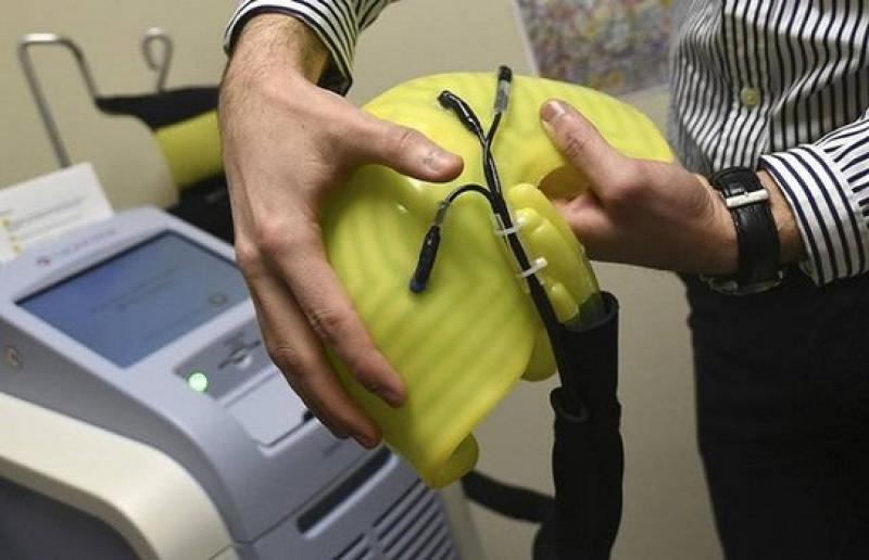 Chemotherapy Devices Market, Chemotherapy Devices Market Industry, Chemotherapy Devices Market Outlook,