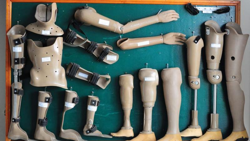 Orthosis and Prosthetics Market