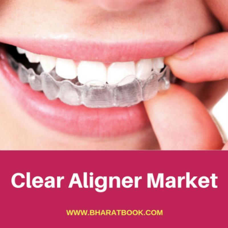 Global Clear Aligner Market - Industry Trends, Opportunities and Forecasts to 2013-2023