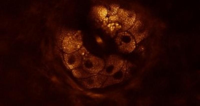 Coherent Anti-Strokes Raman Scattering Microscopy