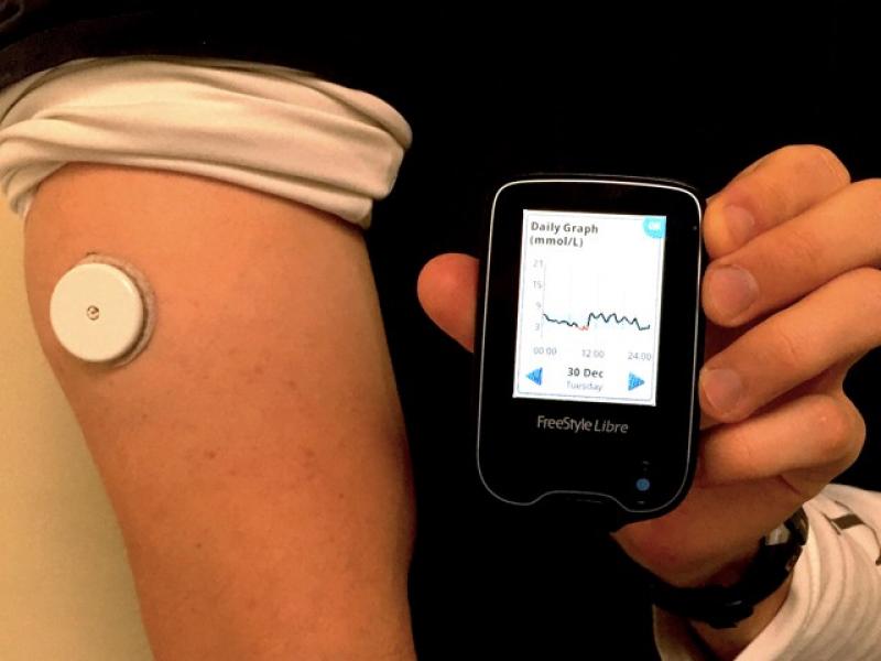 Continuous Glucose Monitoring