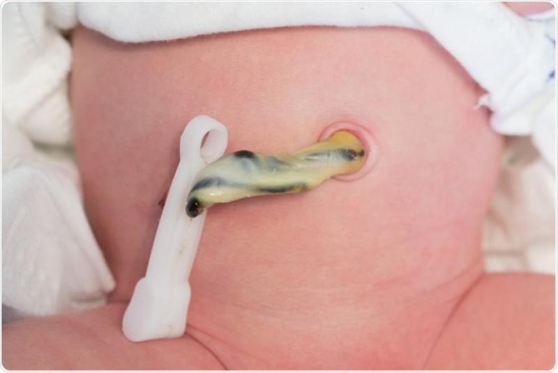 Cord Clamps Industry