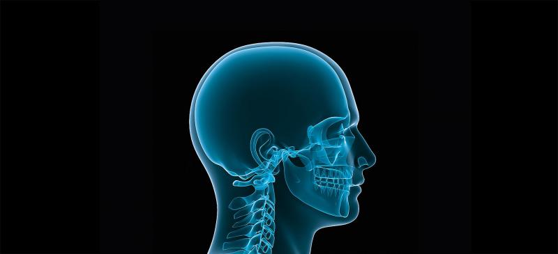 Craniomaxillofacial (CMF) Devices And Equipment Market Share, Restraints, Segments And Regions