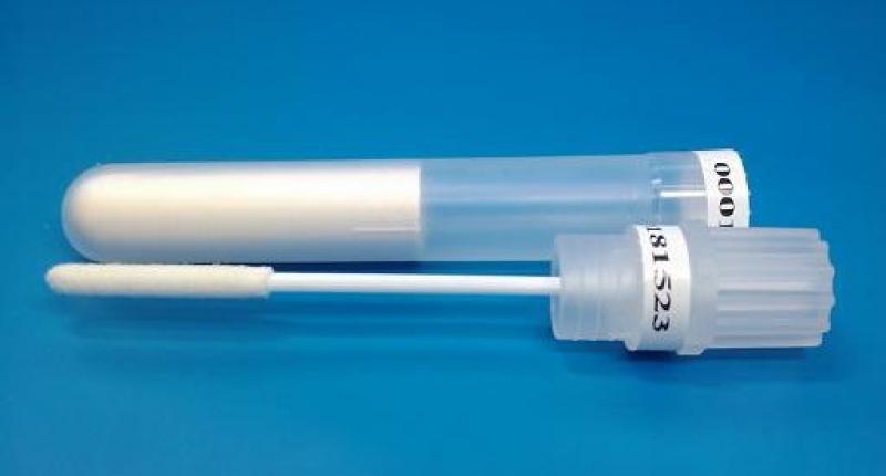 Global DNA Sampling Swab Industry Situation and Prospects Research report DNA Sampling Swab