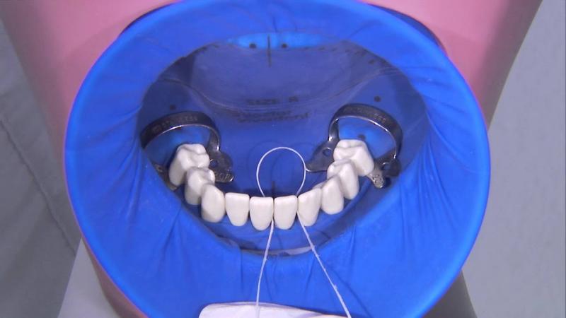 Dental Dam Market 