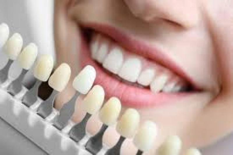 Dental Implants Market