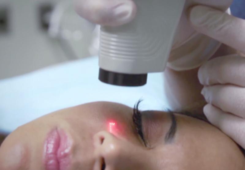  Dermatology Lasers