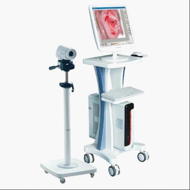 Digital Electronic Colposcope Market 