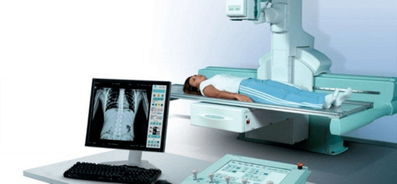 Digital Fluoroscopy Systems