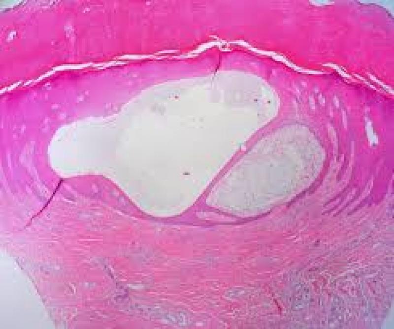 Digital Pathology Market