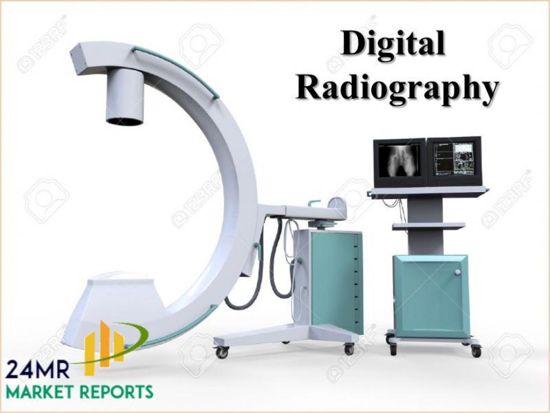 United States Digital Radiography Market by Manufacturers, States, Type and Application, Forecast to 2022 Digital Radiography