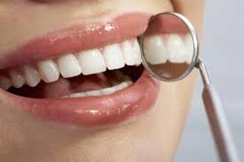 Direct Restorative Materials of Dental Consumables