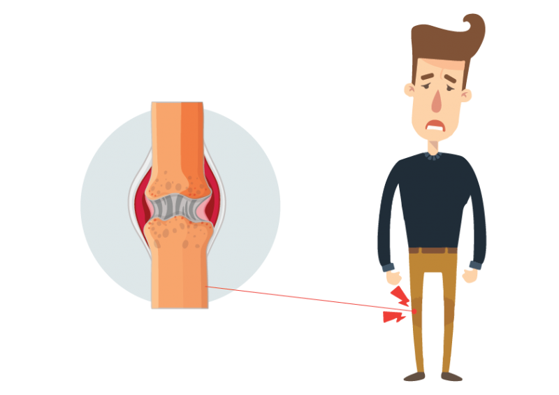 ArthritisTreatmentCenterNagpur, RheumatoidArthritisSymptoms, WhatCausesArthritis ,RheumatoidArthritisTreatmentNagpur , RheumatoidArthritisMedicationsNagpur ,ArthritisRemediesNagpur,AyurvedicTreatmentArthritisNagpur ,AyurvedicTreatmentKneePainSwellingNagpur , AyurvedicTreatmentKneeArthritisNagpur, RheumatoidArthritisNaturalTreatmentNagpur, AchillesTendonInjuryTreatmentNagpur, AchillesTendonitistreatmentNagpur,AchillesTendonPainTreatmentNagpur , AchillesHeelPainNagpur, AyurvedicTreatmentMeniscusTearNagpur, Me