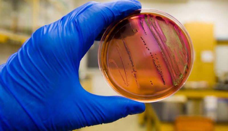 E. Coli Testing Market