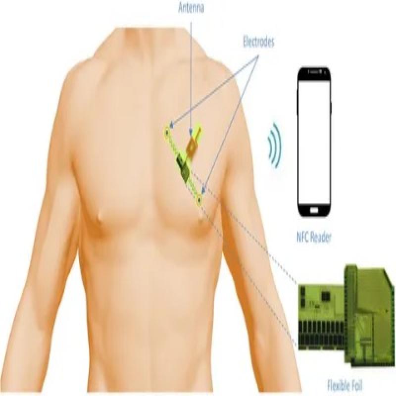 Revolutionary ECG Sensor Patch Technology Transforming Cardiac ...