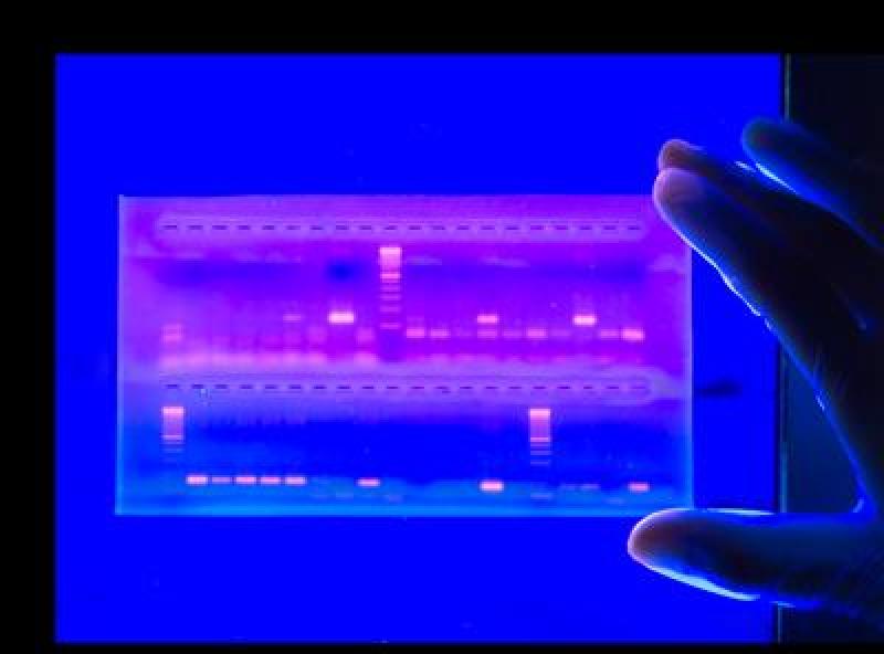 Electrophoresis